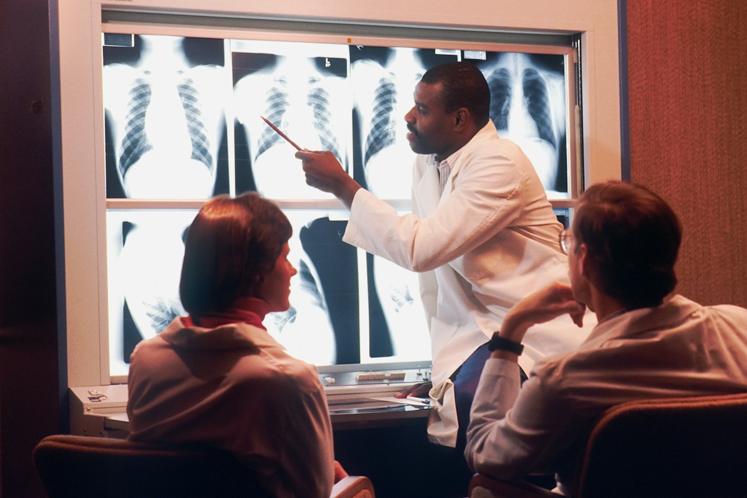 How High Blood Pressure Directly Affects Your Kidneys